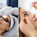 IPL vs Eye Drops: Which Dry Eye Care Fits?